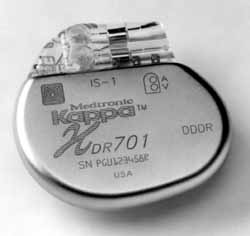 Pacemaker1.jpg