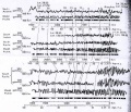 Geophysical Signal Processing 1992 Magnetic Signal Attribution.jpg